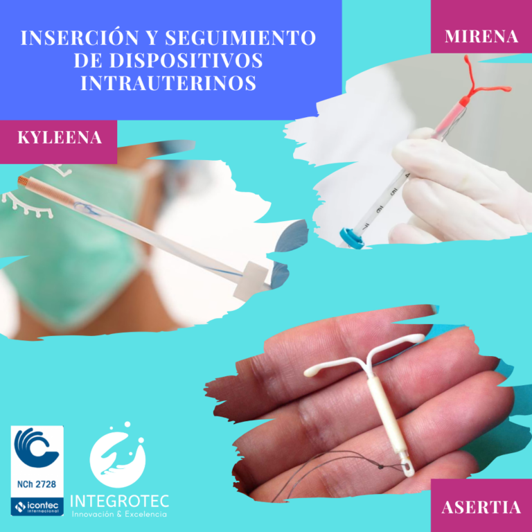 Inserción de Dispositivos Intrauterinos Temuco INTEGROTEC